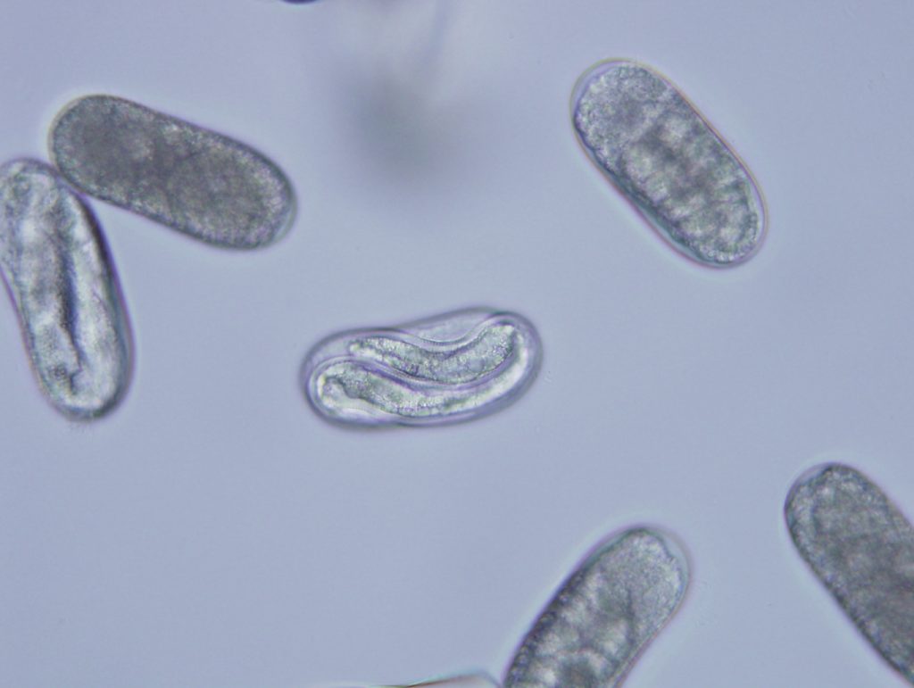 Soybean cyst nematode eggs under a microscope