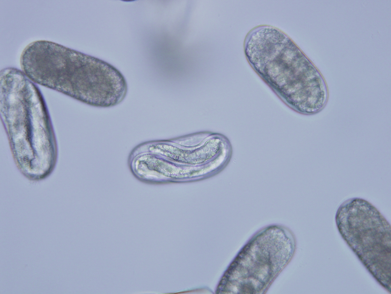 Soybean cyst nematode eggs under a microscope